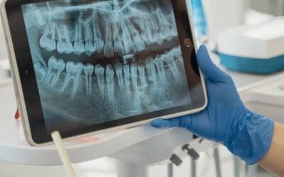 What Is the Point of Dental X-rays?