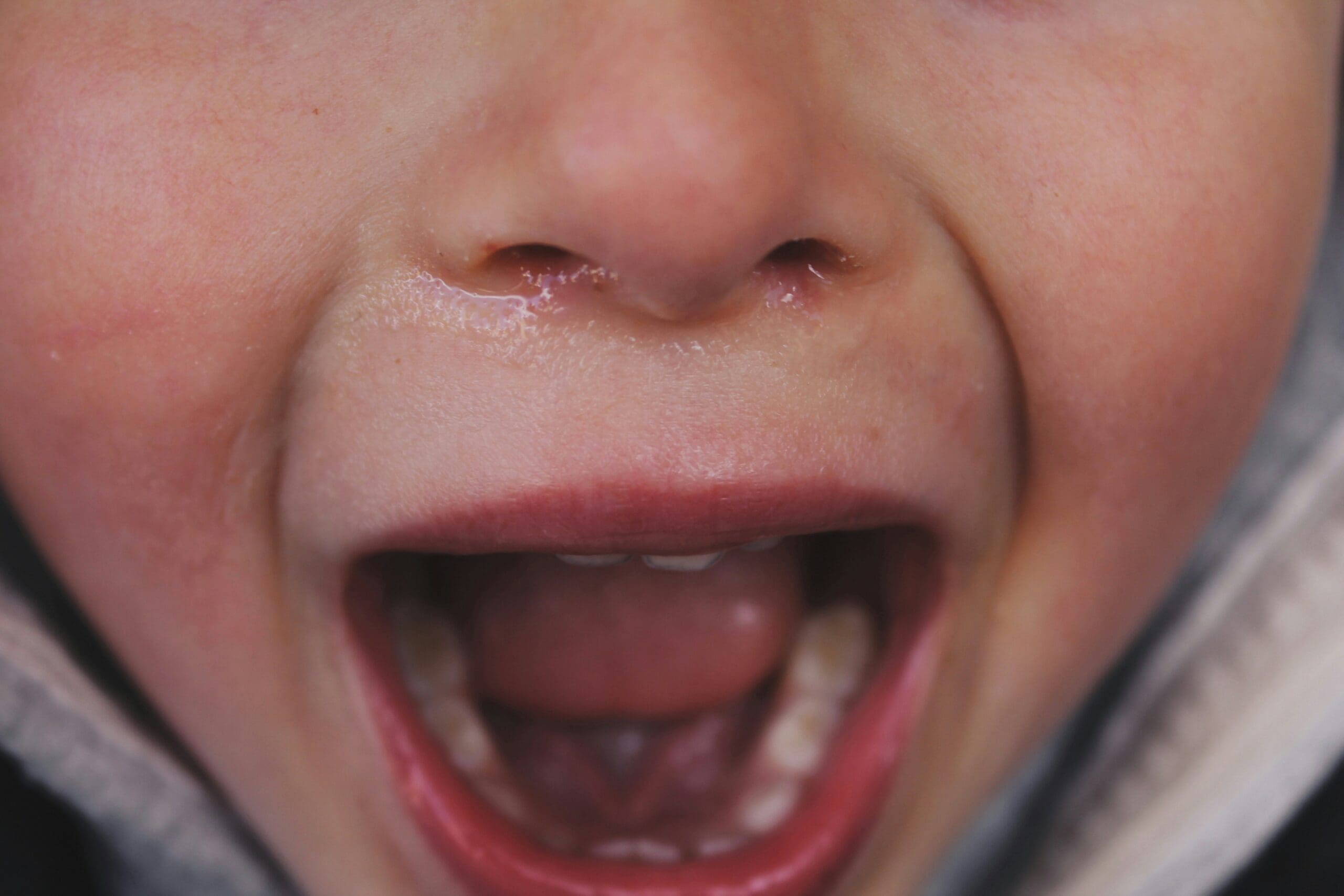 A young child has his mouth open with bottom row of teeth showing