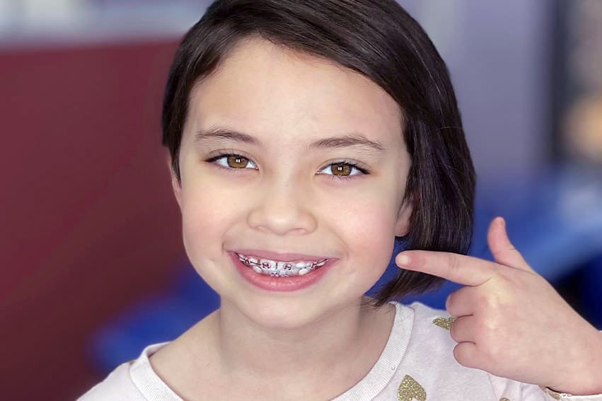 A child showing braces Pediatric Orthodontics - child with braces.