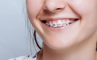 Comparing Orthodontic Options for Kids: Braces, Aligners, and More