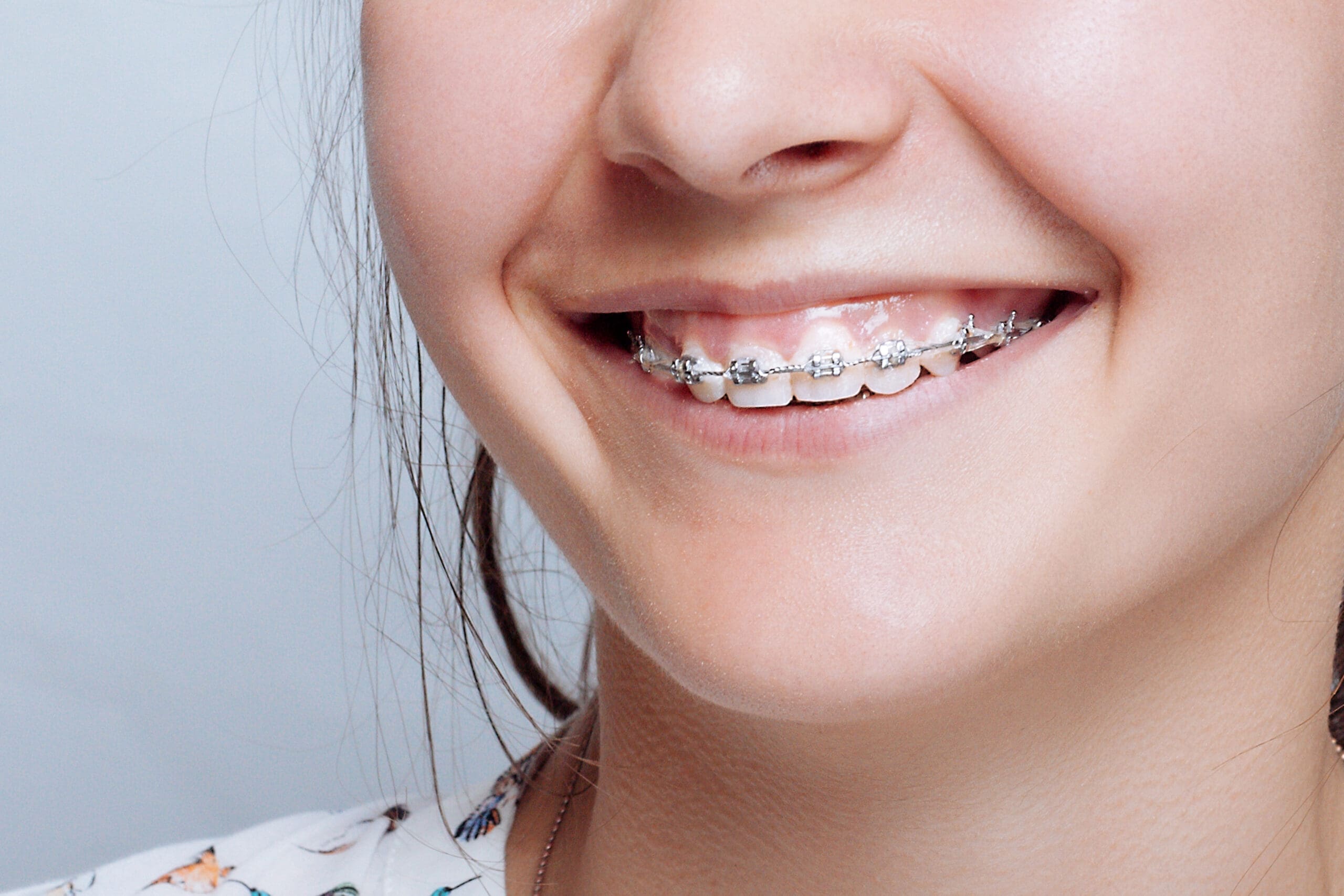 girl with braces smiling